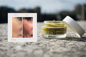 JustUs Skincare anti aging before and after